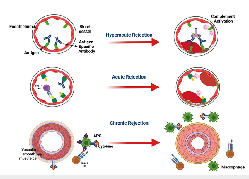 Clinical-Stages-of-Graft-Rejection-Notes-APCAntigen-Presenting-Cell-CDClusters-of