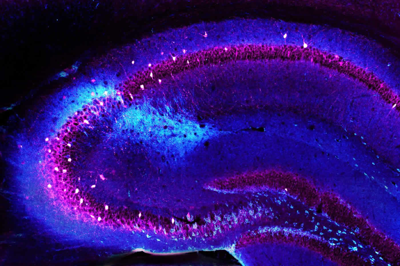 ca2-inhibitory-neurons-hippocampus-schizophrenia